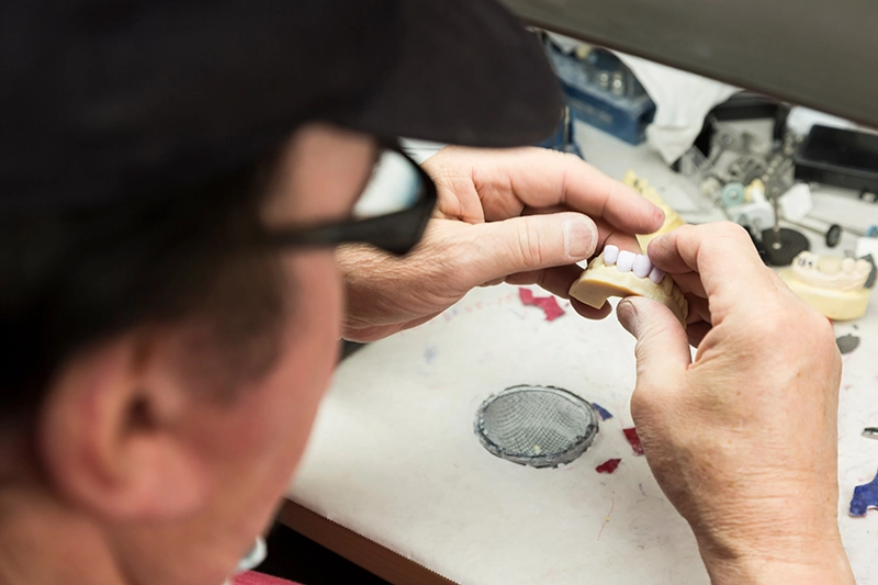 In-house dental lab