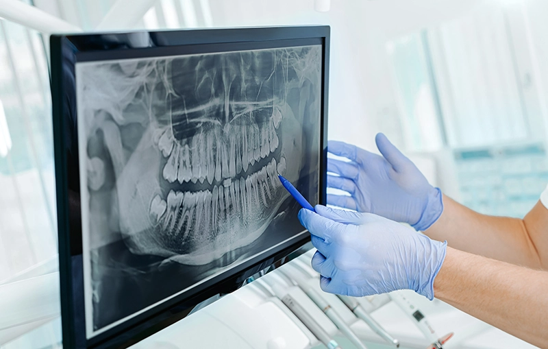 Digital X-Rays