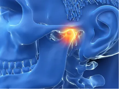 TMJ Treatment