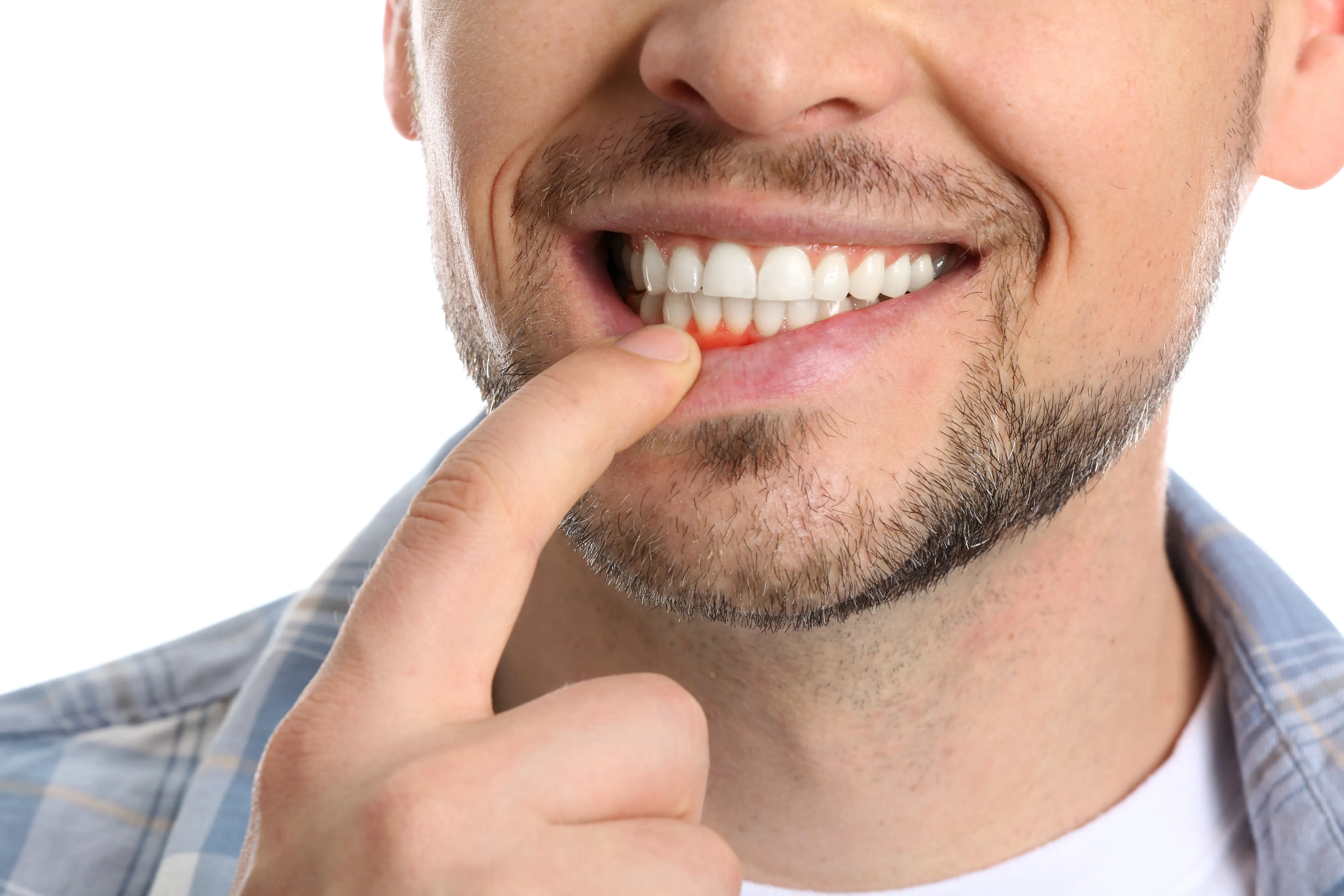 Patient showing healthy smile after dental implant treatment