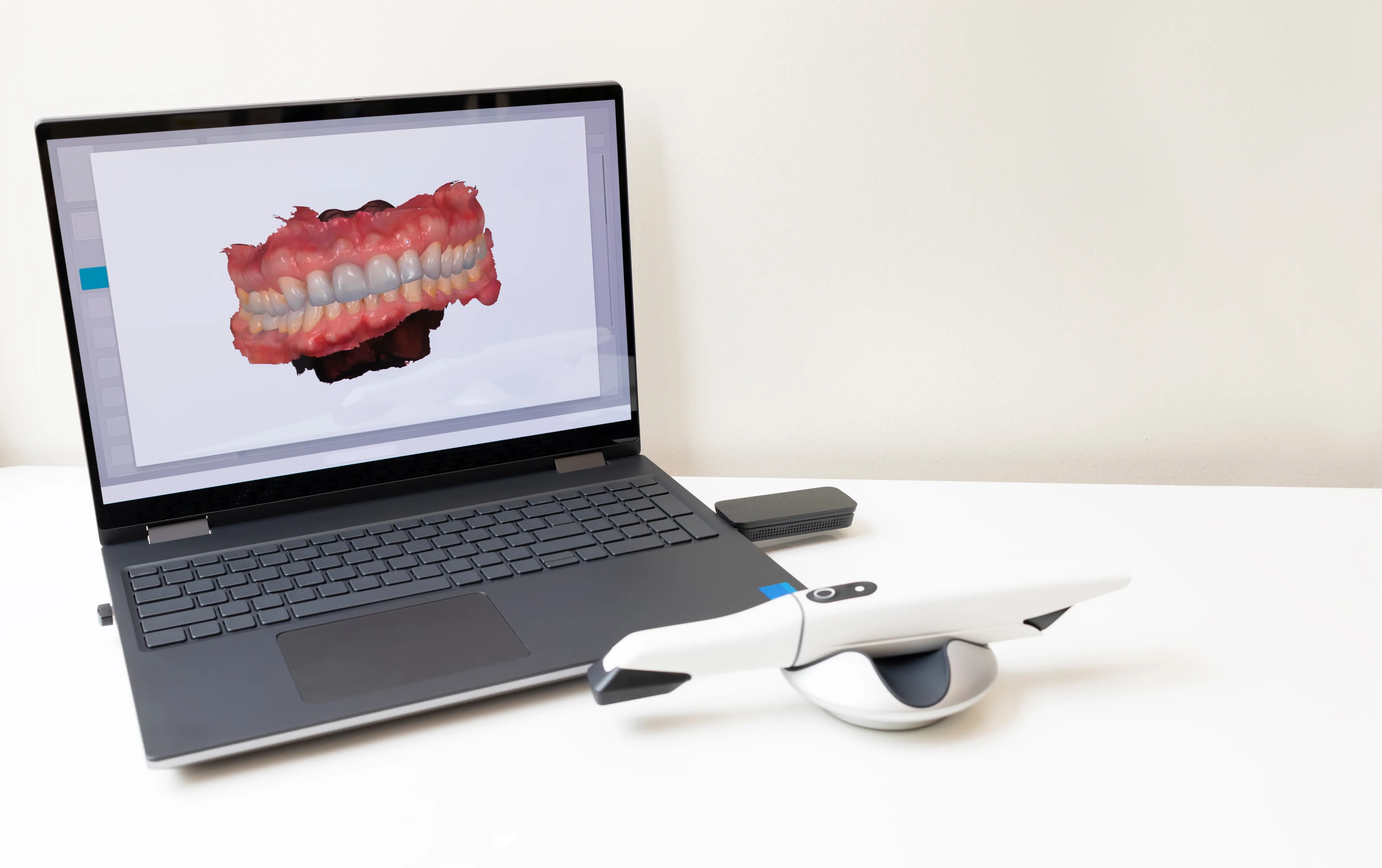 Intraoral Care