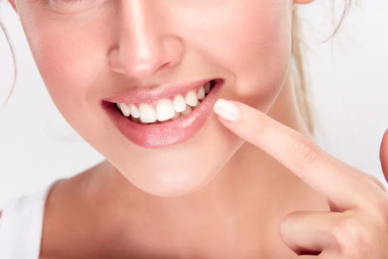 Woman showing beautiful smile after Snap-On Smile treatment