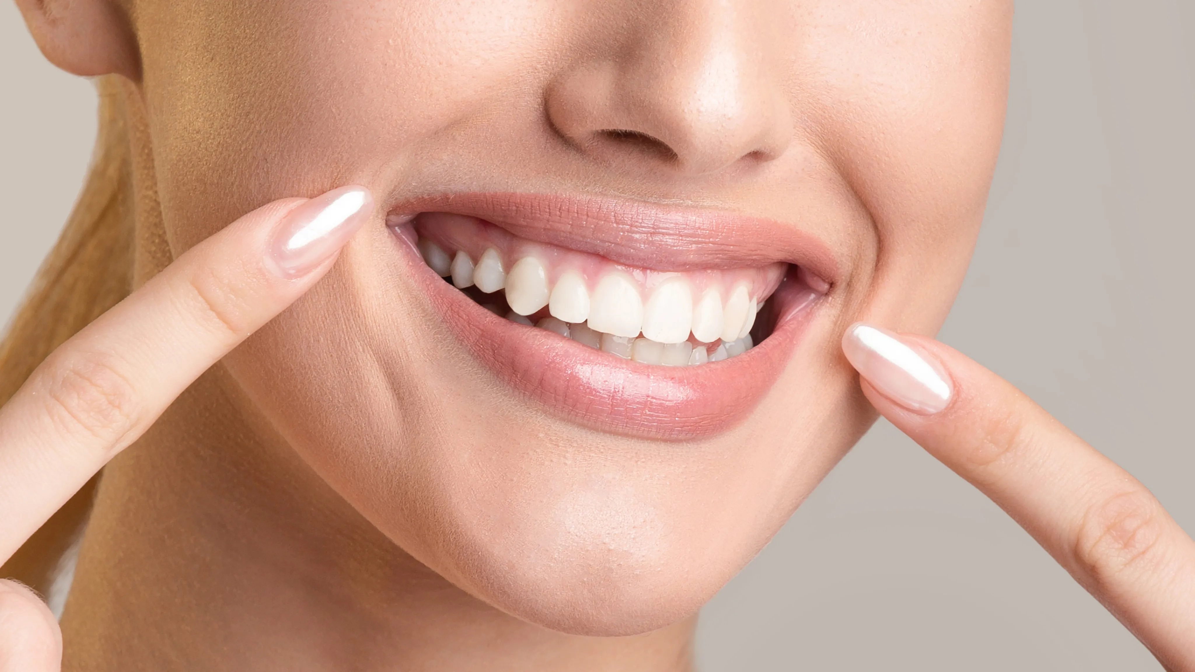 Snap-On Smile®